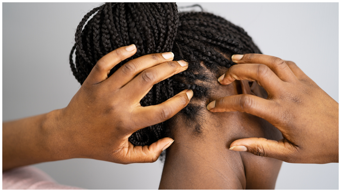 Scalp Acne, Itchiness, and Flakes? Here’s What Your Scalp Is Trying to Tell You
