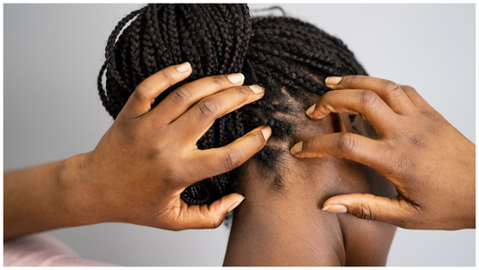 Scalp Acne, Itchiness, and Flakes? Here’s What Your Scalp Is Trying to Tell You
