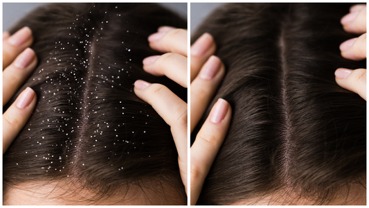 Why Your Scalp Is Itchy — And How to Fix It (Fast)